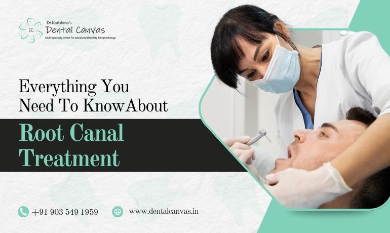 Everything You Need to Know About Root Canal Treatment