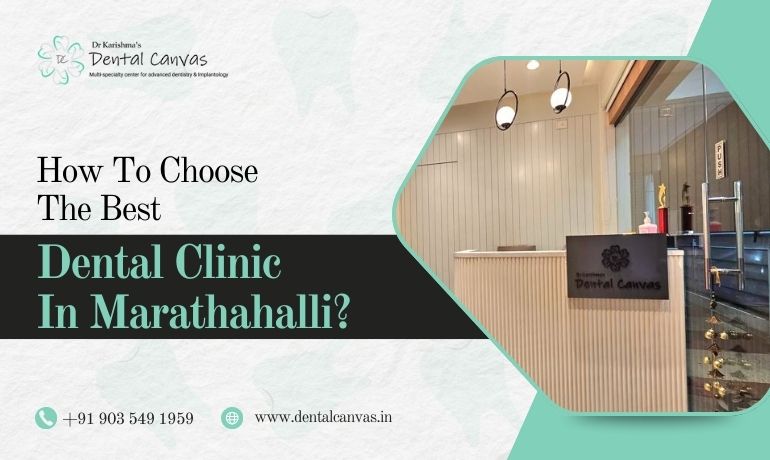 How to Choose the Best Dental Clinic in Marathahalli