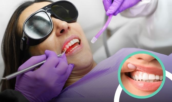 Bleeding Gum Treatment In Marathahalli Bangalore