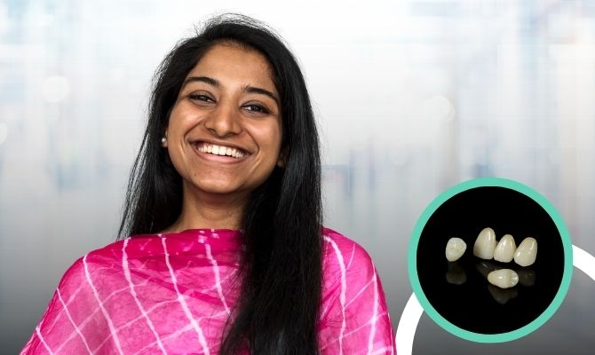 Emax Crowns In Marathahalli Bangalore