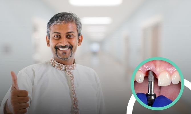 FIxed Teeth In A Day In Marathahalli Bangalore