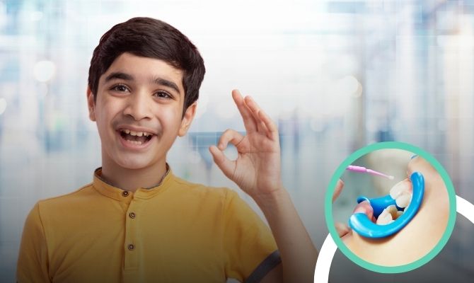 Fluoride & Dental SealantsIn Marathahalli Bangalore