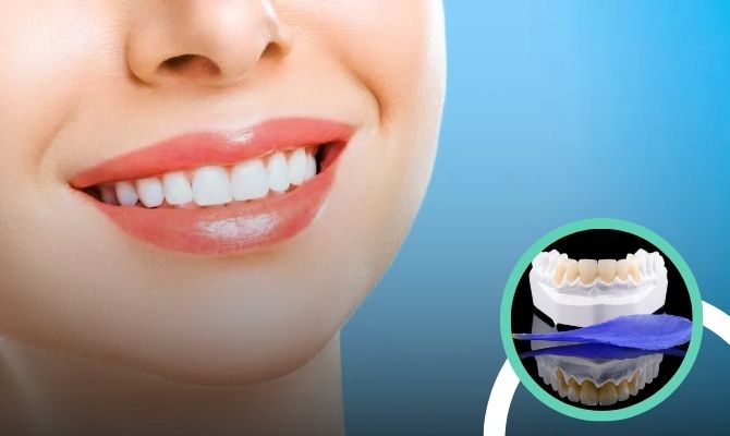 Smile Makeover In Marathahalli Bangalore