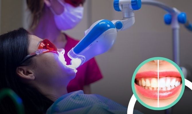 Teeth Whitening  In Marathahalli Bangalore